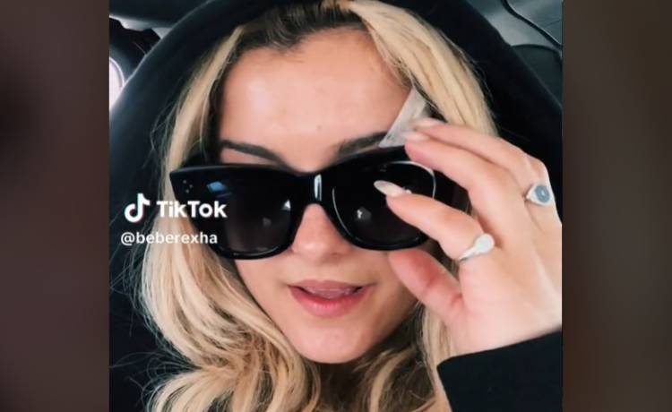 Dostała telefonem w twarz. Bebe Rexha pokazuje, jak wygląda po wypadku [WIDEO]