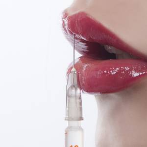 Ma największe usta na świecie. 23-letnia Bułgarka przeszła ponad 20 zabiegów i planuje kolejne