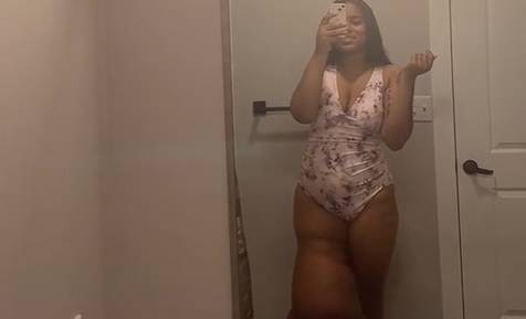 Modelka ma nogę ważącą 45 kilogramów. Nieuleczalnie chora promuje samoakceptację [FOTO]