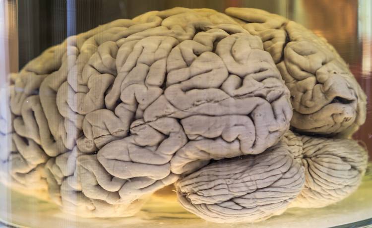  Przez 3 lata miała katar. Okazało się, że z nosa wyciekał jej płyn mózgowo-rdzeniowy 