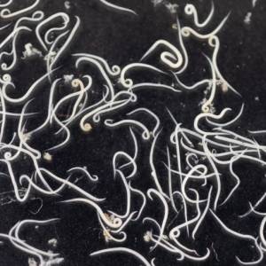 W jego mózgu znaleleziono larwy tasiemca. 18-latek zamarł dwa tygodnie po tym, jak trafił do szpitala