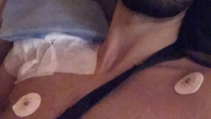 "Hotel Paradise 3". Koszmarny wypadek uczestnika. Uruchomiono zbiórkę na leczenie. "Czas ma ogromne znaczenie"