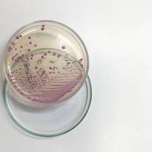 Zakaz kąpieli w kąpielisku w Gdańsku. Wykryto bakterię E. Coli