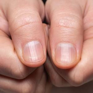 Nie masz lunuli? Medycyna tłumaczy, co to oznacza