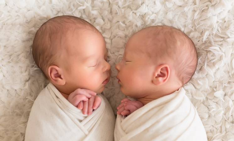 Dziewczynki urodziły się zrośnięte głowami, po roku zostały rozdzielone [WIDEO]