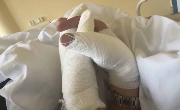 Modelka ma poparzoną całą twarz. Miała koszmarny wypadek. O pomoc apeluje Julia Wieniawa