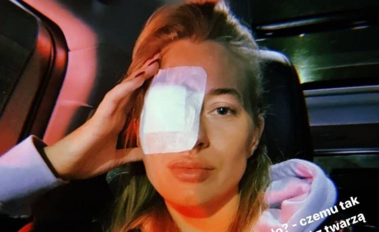 Marcelina Zawadzka trafiła do szpitala. Wszystko przez popularny zabieg upiększający [FOTO]