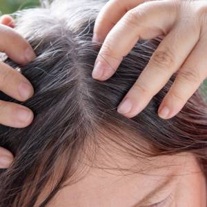 Przedwczesne siwienie - odkryj 5 nieoczywistych przyczyn!