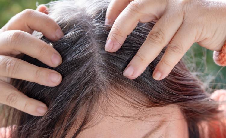 Siwienie, fot. Shutterstock/Kittyfly