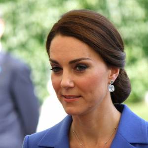 Ślady pobicia na twarzy księżnej Kate?! "To jawne wprowadzanie w błąd" [FOTO]