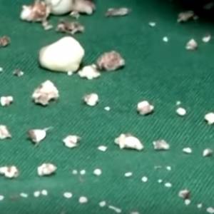 Chłopczyk miał w szczęce... 526 zębów! 7-latek jest już po zabiegu