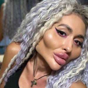 Ma "największe policzki świata". Udostępniła zdjęcie sprzed modyfikacji. Trudno ją rozpoznać! [FOTO]