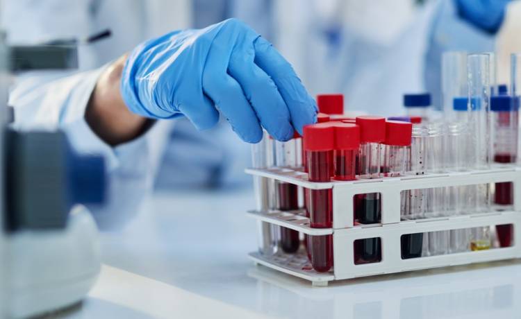 „Złota krew” – medyczna zagadka. Tak rzadką grupę ma garstka ludzi na świecie, fot. Shutterstock