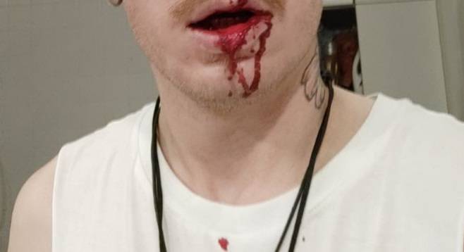 Gwiazdor "Gogglebox" brutalnie pobity! Opublikował drastyczne nagranie [WIDEO]                