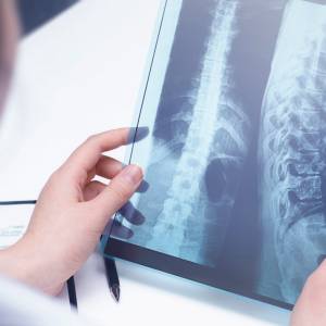 Naukowcy odkryli cząsteczki, które naprawiły rdzeń kręgowy. To może być przełom!