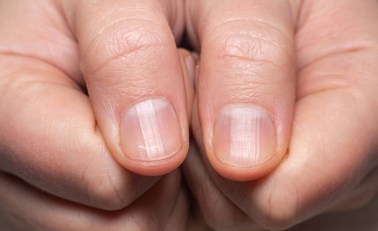 fot. shutterstock.com 