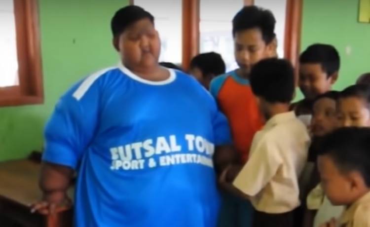 Najbardziej otyłe dziecko świata. Trudno uwierzyć, jak bardzo zmienił się Arya! [FOTO]