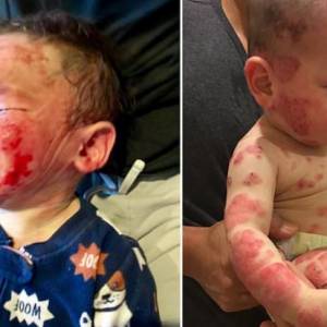 Dziecko straszliwie cierpiało. Nikt nie wiedział, co mu jest!