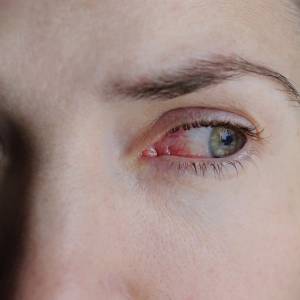 Swoją pomyłkę mogła przypłacić utratą wzroku. Celebrytka pomyliła krople do oczu z klejem [WIDEO] 