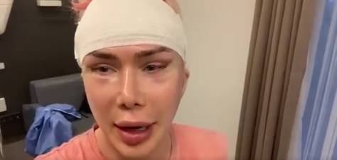 Brytyjski influencer przeszedł 18 operacji plastycznych, by upodobnić się do swojego idola. Przemiana trwała 8 lat. "W końcu mam koreańskie oczy"