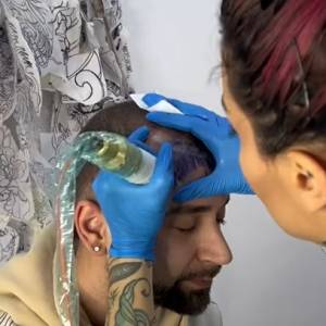 Brak włosów rozwiązał... tatuażem. Efekt nie spodobał się internautom: "To musi być żart [WIDEO]