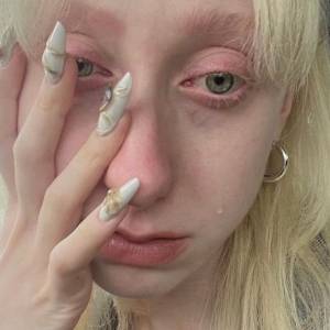 Po Eurowizji musiała długo płakać. Luna pokazała szokujące zdjęcia [FOTO]