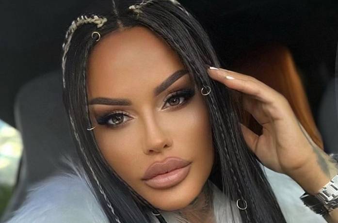 Laluna opowiedziała o planach na kolejne operacje. Chce zmniejszenia piersi 