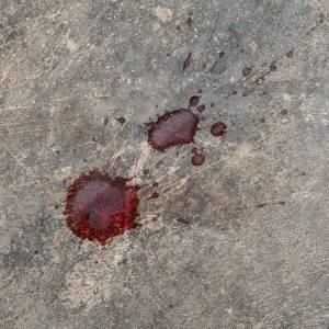 Popularny wokalista disco polo pobity do nieprzytomności. Ma "wielokrotne złamania kości czaszki i twarzoczaszki"