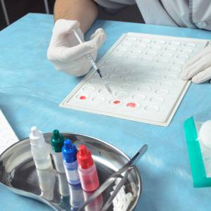 Chińscy naukowcy twierdzą, że grupa krwi ma wpływ na ryzyko zarażenia koronawirusem