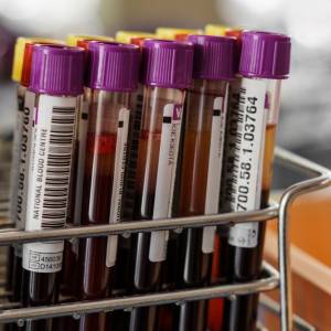 Atak nożownika w Gdańsku: Apel o krew dla Pawła Adamowicza                                                                                                           