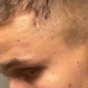 "Hotel Paradise 2". Sprawcą pobicia Łukasza inny uczestnik? Kolega z programu przerwał milczenie