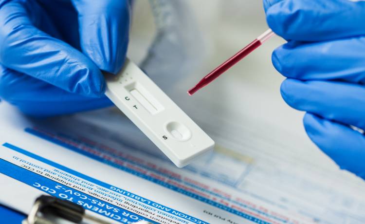 Nowe przepisy! Wizyta lekarza w ciągu 48h? A testy covidowe w aptekach będą bezpłatne