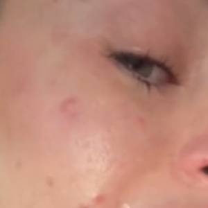 Powiększyła sobie usta. Prawie eksplodowały. "Wyglądam przerażająco" [WIDEO]