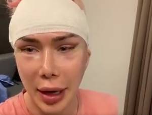 Brytyjski influencer przeszedł 18 operacji plastycznych, by upodobnić się do swojego idola. Przemiana trwała 8 lat. "W końcu mam koreańskie oczy"