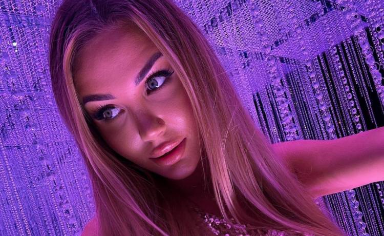 Angela Dańczak z "Love Island" pokazała, jak teraz wygląda. Ma poparzoną całą twarz! [FOTO]