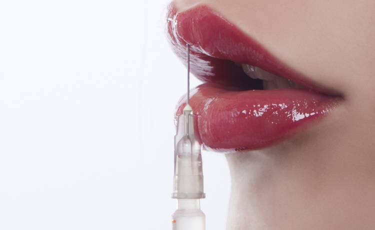 Ma największe usta na świecie. 23-letnia Bułgarka przeszła ponad 20 zabiegów i planuje kolejne