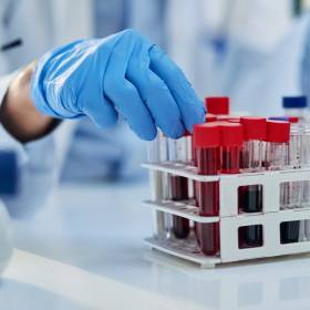 „Złota krew” – medyczna zagadka. Tak rzadką grupę ma garstka ludzi na świecie