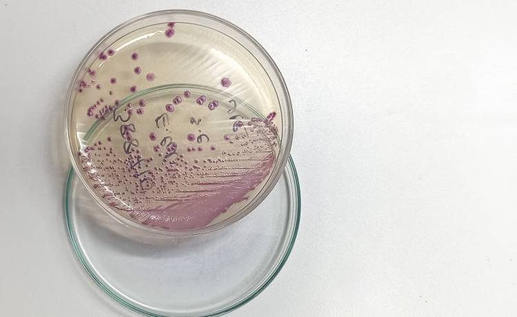 Zakaz kąpieli w kąpielisku w Gdańsku. Wykryto bakterię E. Coli