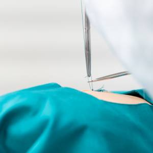 Przeszła operację plastyczną, niedługo później zmarła