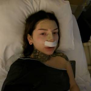 Marcysia z Ekipy miała operację! "Strasznie mnie boli" [WIDEO +18]