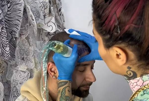 Brak włosów rozwiązał... tatuażem. Efekt nie spodobał się internautom: "To musi być żart [WIDEO]