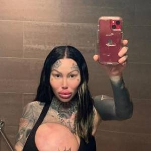 Dramat influencerki. Wybuchł jej 10-kilogramowy implant w piersi [FOTO]