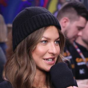 Anna Lewandowska zdecydowała się na operację. Tak zaingerowała w wygląd 