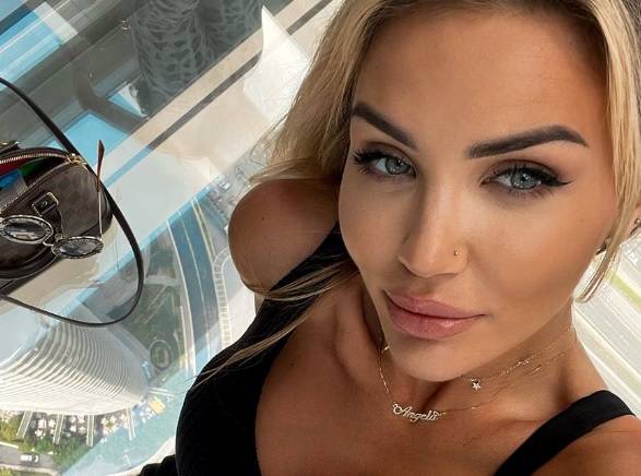 Angela z "Love Island" usunęła implanty piersi. Zabrała głos po operacji 
