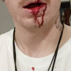 Gwiazdor "Gogglebox" brutalnie pobity! Opublikował drastyczne nagranie [WIDEO]                