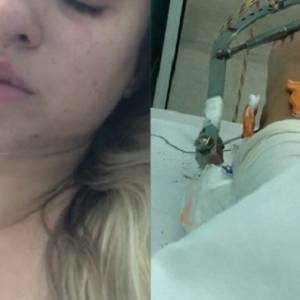 Artystka disco polo miała koszmarny wypadek. Siostra błaga o pomoc!                                          