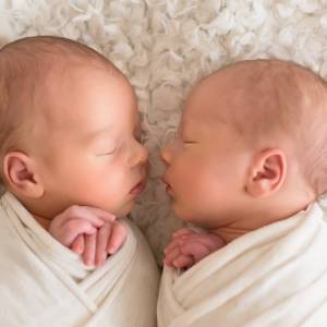 Dziewczynki urodziły się zrośnięte głowami, po roku zostały rozdzielone [WIDEO]