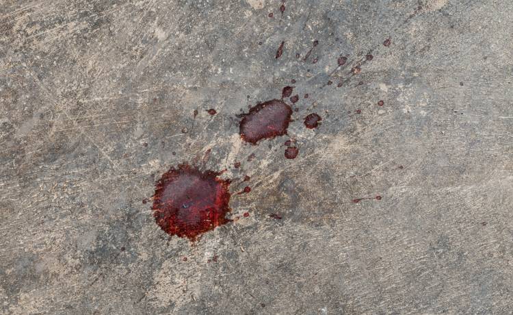 Popularny wokalista disco polo pobity do nieprzytomności. Ma "wielokrotne złamania kości czaszki i twarzoczaszki"