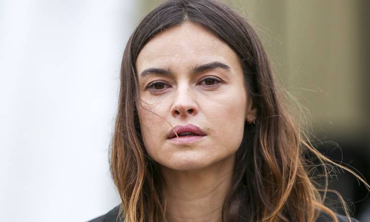 Polska modelka poruszająco o chorobie. Kasia Smutniak cierpi na bielactwo