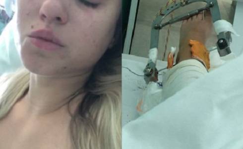 Artystka disco polo miała koszmarny wypadek. Siostra błaga o pomoc!                                          